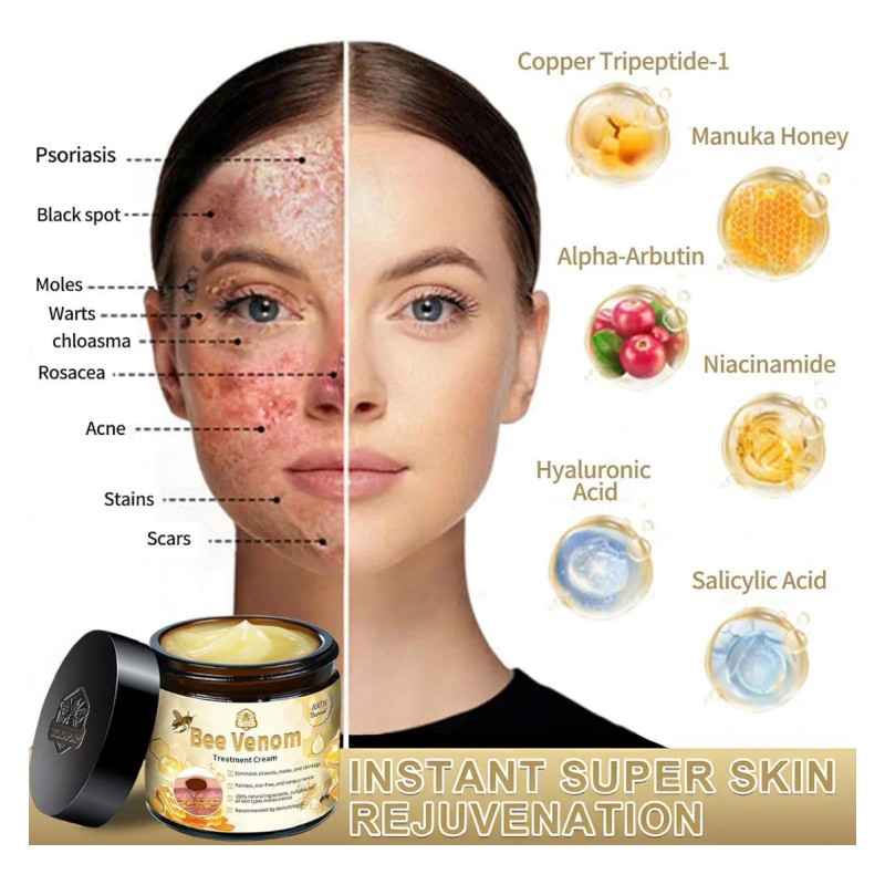 Creme De Tratamento Pele De Abelha,todas As Partes Do Co