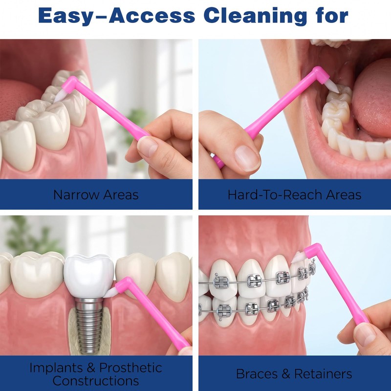 8Pcs Soft End Tuft Toothbrush Orthodontic Tapered Brush Detail Cleaning