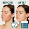 Glycolic Acid 20% Exfoliating Pads – Anti-Aging Face Pads with