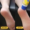 Aavini Intense Foot Cream - Repairs Cracked Skin, Antibacterial and