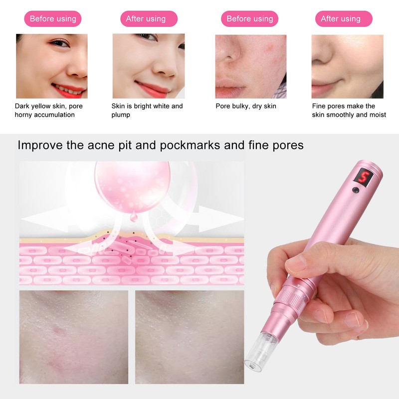 Electric Micro Needle Pen Rechargeable 5 Gears Derma Rolling Pen