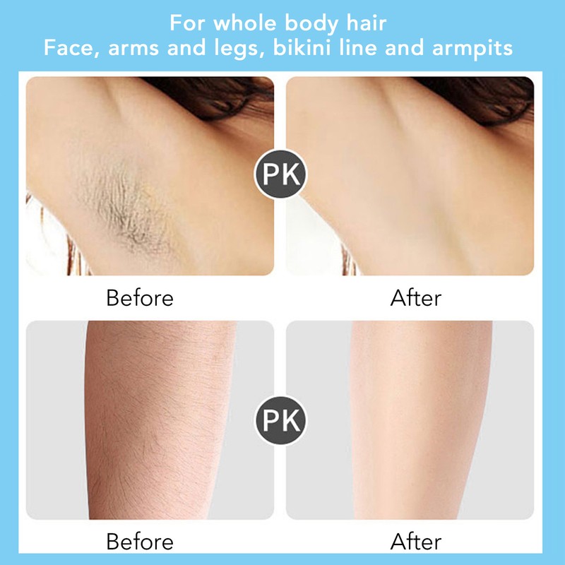 Women Painless Hair Removal Rechargeable With Washable Blades for Armpits