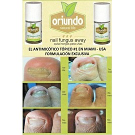 ORIUNDO Nail Fungus Away (Quita Hongos para Uñas) 0.5 Oz  New USA Natural Life