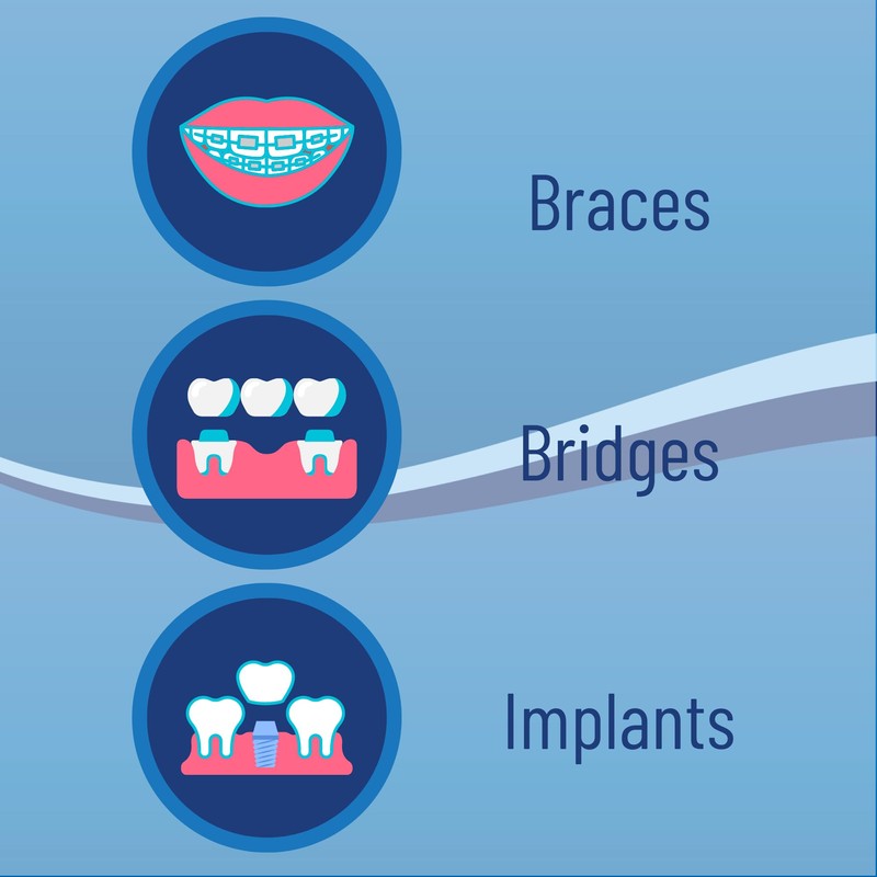 OrVance Threader Floss ­­­- Designed to Floss Through Braces, Bridges,