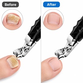 Wide Jaw Toenail Clippers for Thick Nails – Angled Stainless Steel Nail Cutter for Seniors & Home Foot Care