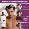 2pzs Shampoo Lexenic Excalvo Con Cebolla Y Aceite De Romer