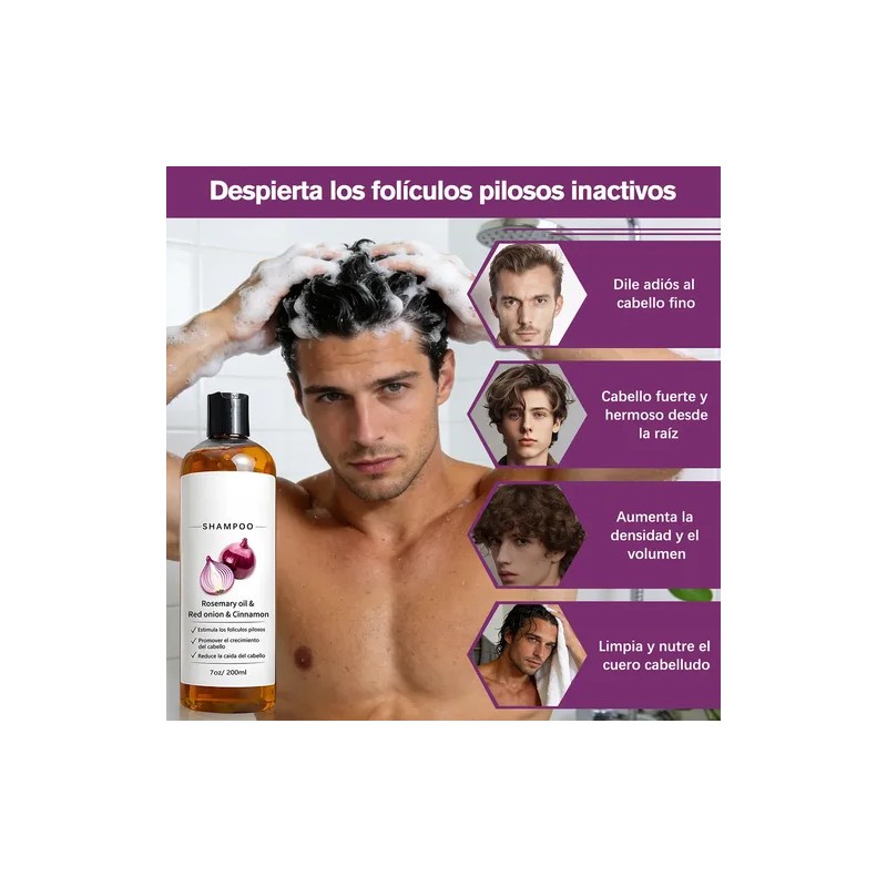 2pzs Shampoo Lexenic Excalvo Con Cebolla Y Aceite De Romer