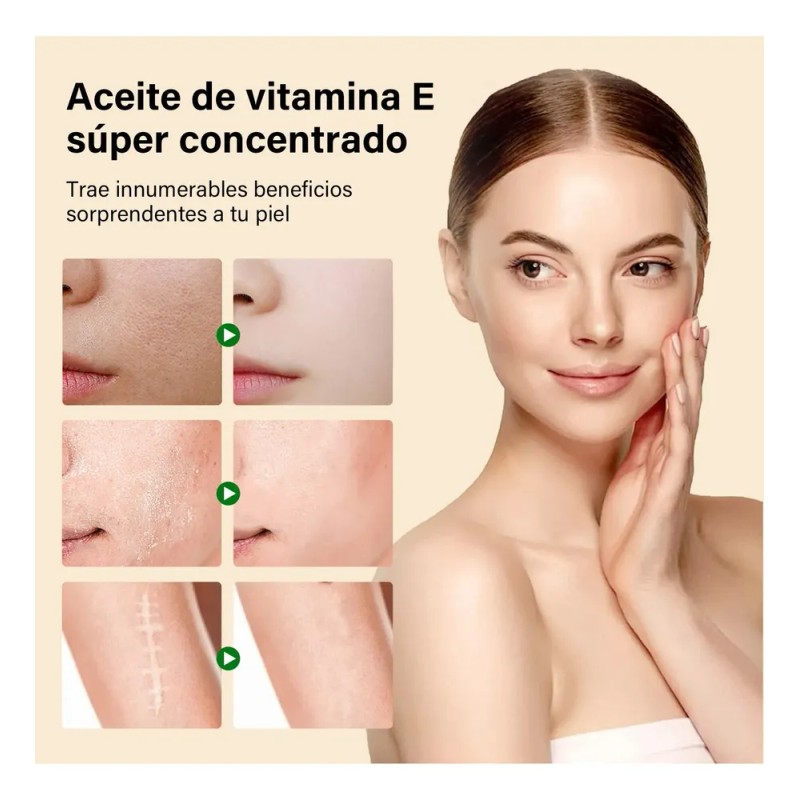 Vitamina E Cara-aceite Que Aclara Manchas+crema Piel Firme