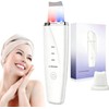 Peeling ultrasónico facial LOTOVERDE 4‑modos – Limpieza profunda y lifting