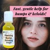 Urban ReLeaf Piercing Bump Shrinking Drops! Keloid Bumps Gentle Effective