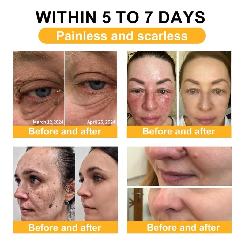 , Crema De Tratamiento, Crema Profesional Para El