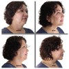 Bring It Up Instant Neck Lift Tape 30 Day Supply,