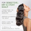 Nioxin Scalp Relief System Kit for Sensitive, Dry & Itchy