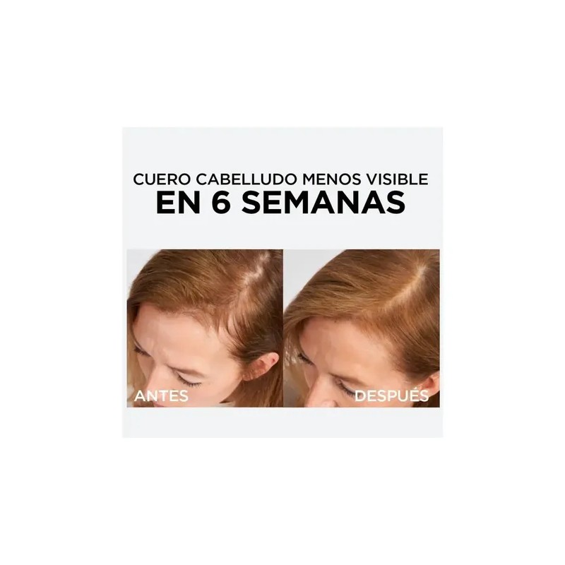 Shampoo Y 2 Serum Anticaida Loreal Aminexil Para 60 Días