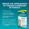 Reparador De Uñas Fúngico Opti-nail Restaura Una Apariencia