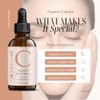 Suero Facial con Vitamina C, Acido Hialuronico, Vitamina E, Sabila