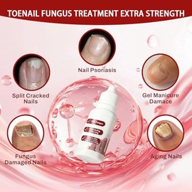 Fungi Nail ToenailTreatment,Gentle Formula,Effectively lmproves Nails for a More Beautiful Appearance（1PCS）