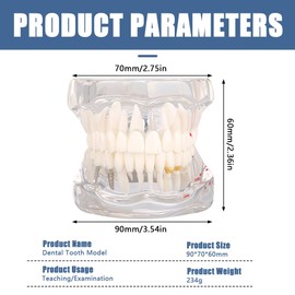 Uadme Typodont Teeth Model, Standard Transparent Dental Model with Implants & Removable Teeth, Tooth Pathological Teaching for Anatomy Demonstration, Disease Presentation & Implantology Study