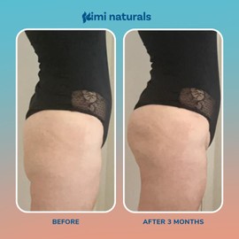 KIMI Naturals Curvy Peaches Butt Enhancement Cream for Fast Growth - High Strength Booty Cream for Firming, Shaping, Tightening, and Plumping - Natural Booty Growth and Lift - Brazilian Butt Lift