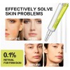 Sérum Reafirmante Para Rostro Retinol Shot, 15 Ml Todo Tipo