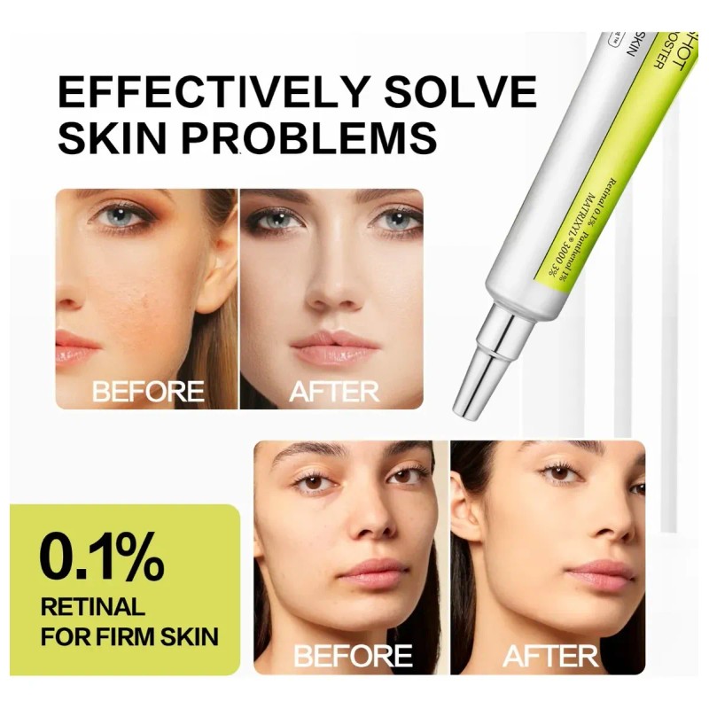 Sérum Reafirmante Para Rostro Retinol Shot, 15 Ml Todo Tipo