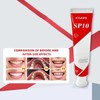 KYUDFE SP-10 Probiotic Toothpaste, Fluoride-Free, Hydroxyapatite, Anti-Plaque, Management - Specification: