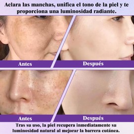 SINYI 2PCS Crema Advanced Anti-Hiperpigmentación,CremA Facial Iluminadora， Crema Eliminadora de Imperfecciones，Adecuado para todo tipo de piel, unifica el tono de la piel