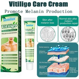 Crema para el vitíligo, crema para el tratamiento del vitíligo, crema para el cuidado del vitíligo corporal para reducir las manchas blancas y la psoriasis (Paquete de 1)