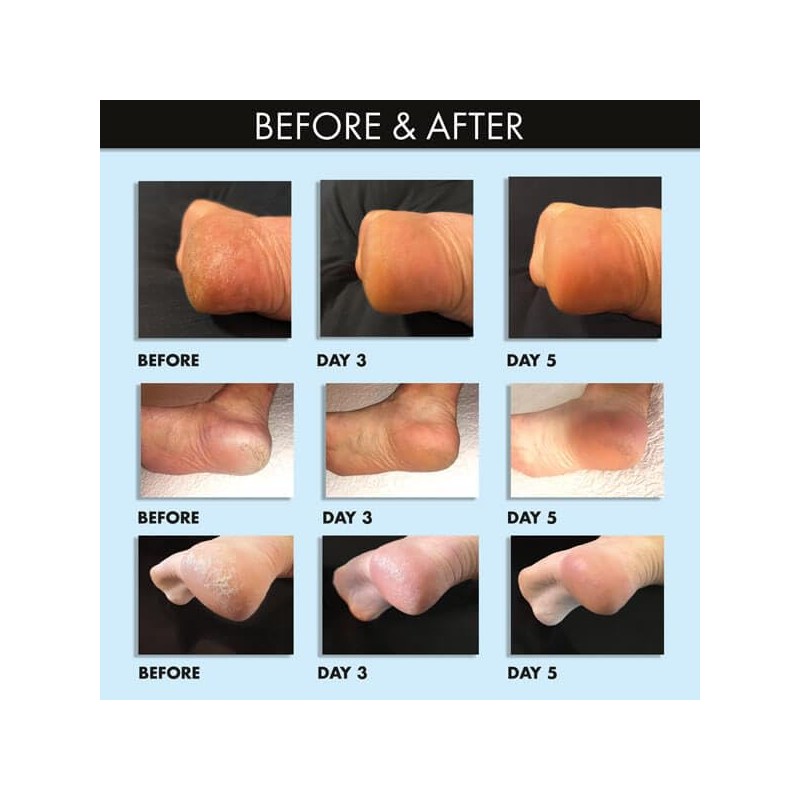 Whish Whish Coconut Milk + Verbena Exfoliating Foot Mask -