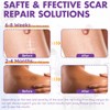 Silicone Scar Sheets, Silicone Scar Tape, Reusable Professional Scar Silicone