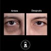 Kit Crecimiento Capilar + Antiojeras | Anti Caída + Bolsas