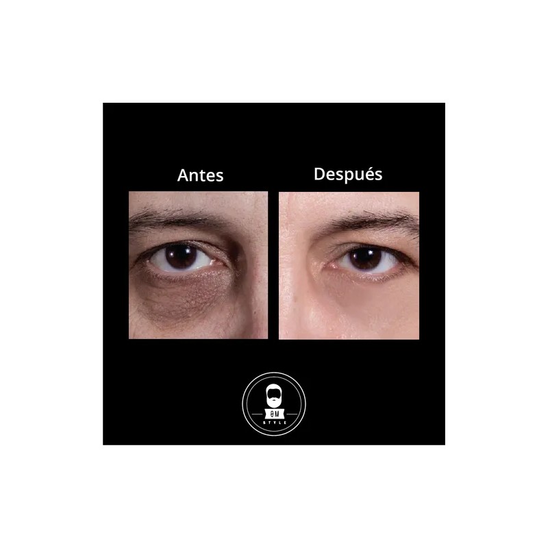 Kit Crecimiento Capilar + Antiojeras | Anti Caída + Bolsas