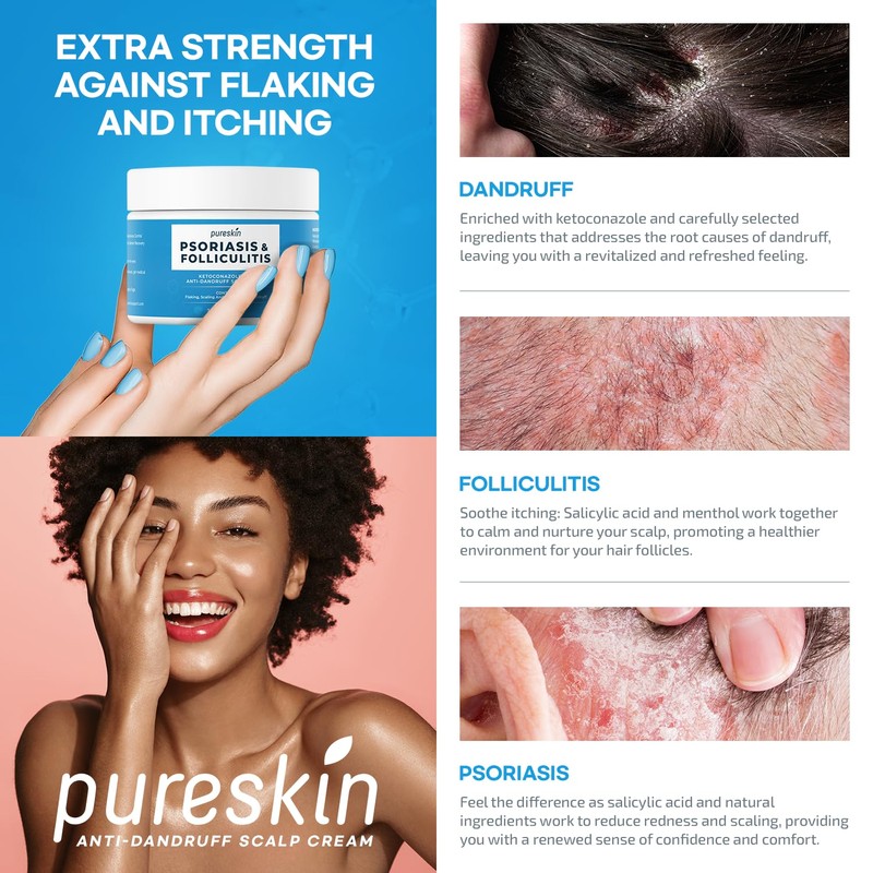 Scalp Cream for Psoriasis Folliculitis, Helps Relieve Itching Flaking, with