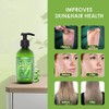 Gel de aloe vera
