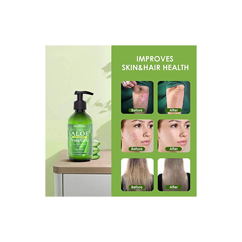 Gel de aloe vera
