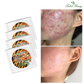 Label Young Skin blemish care/Skin soothing/Recommended for problem skin/Contains Centella asiatica/Face soap/Tiger soap (4 units) / 라벨영  피부결점케어/피부진정/문제성피부추천/병풀함유/세안비누/호랑이비누 4개