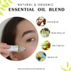 Isabella's Clearly ZITS, Gentle All Natural Acne Treatment for Clear
