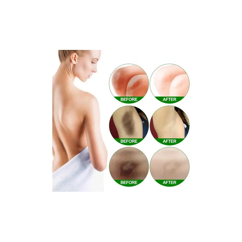 Duo Crema Aclarante Zonas Intimas Perianal Entrepierna Axila