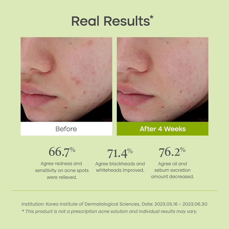 Purito Seoul [Purito Seoul]Clear Code fruit Serum 30ml