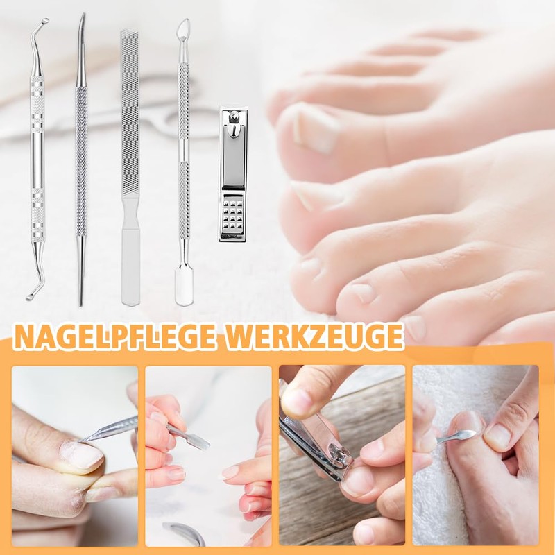 Joycabin Ingrown Toenails Set, Toenail Correction Patch, Ingrown Toenail Correction