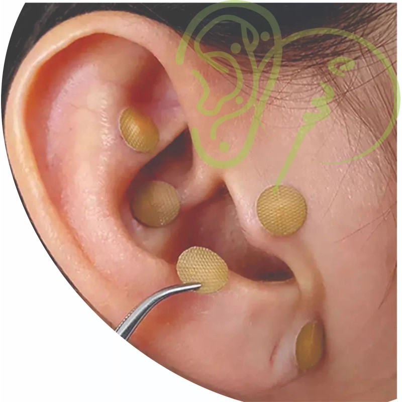 Balines Para Auriculoterapia 500 Piezas