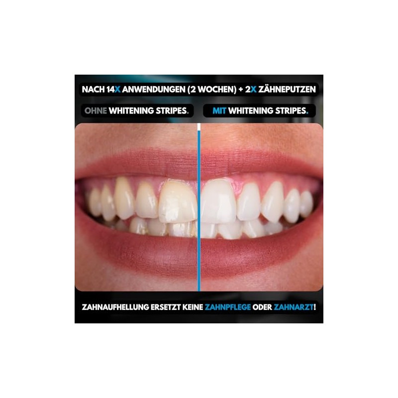The Whitening Strips | Teeth Whitening Strips (28 Strips) for