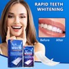 Robofun Whitening Strips, 42 Stück Zahnaufhellung Professionelle, Teeth Whitening Bleaching
