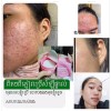 LAKAMO Pore Tightening Essence Pads សំឡីជូតមុខកូរ៉