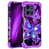 Miqala for Moto G Power 2025 Case,Moto G Play 2025