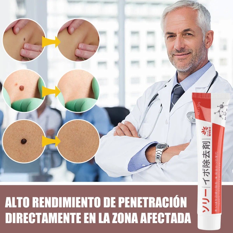 Crema Para Verrugas Elimina Eficazmente Y Cuida La Piel 30g