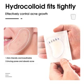 Parches Para Acné | Hidrocoloide + Reducción De Imperfeccion