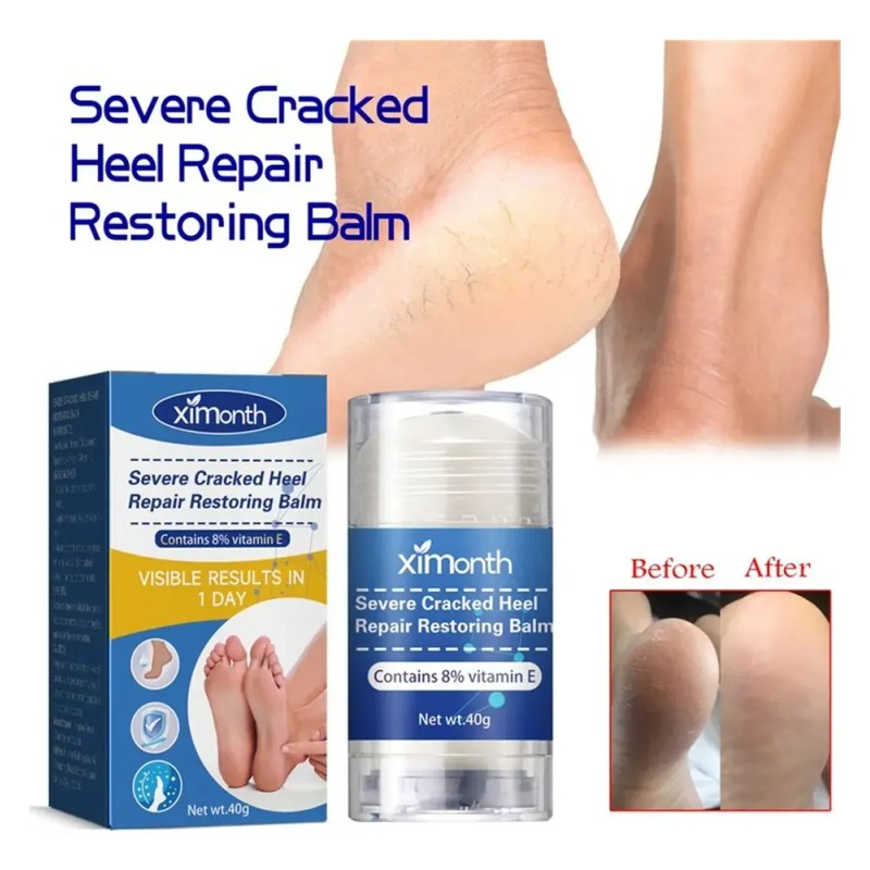 Be - 2×crema Reparadora Grietas Secas Y Talones For Pies