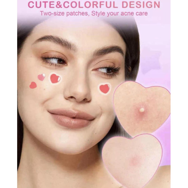 slowsoday Parche Auxiliar Para Granitos Tipo De Piel Mixto