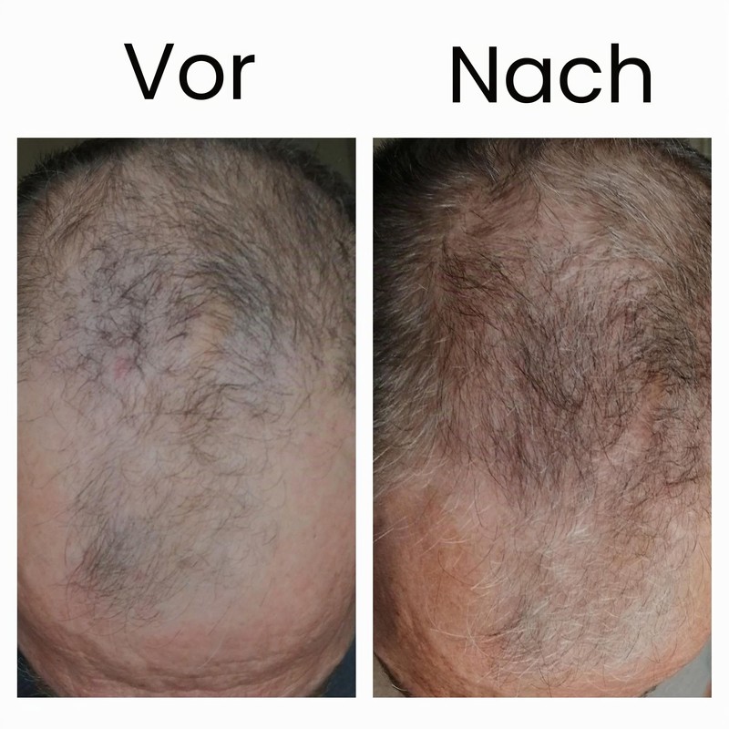 The INKEY List Hair Loss Reduction Serum 150ml